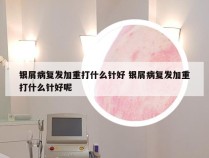 银屑病复发加重打什么针好 银屑病复发加重打什么针好呢