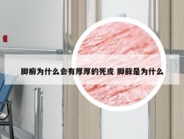 脚癣为什么会有厚厚的死皮 脚藓是为什么