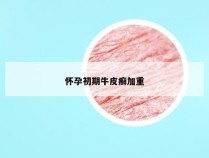 怀孕初期牛皮癣加重