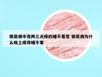 银屑病半夜两三点痒的睡不着觉 银屑病为什么晚上痒得睡不着