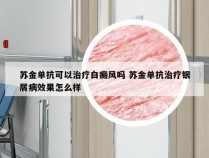 苏金单抗可以治疗白癜风吗 苏金单抗治疗银屑病效果怎么样