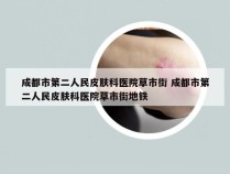 成都市第二人民皮肤科医院草市街 成都市第二人民皮肤科医院草市街地铁
