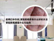 老师们中午好,掌跖脓疱疹有什么好的方法 掌跖脓疱病是什么引起的