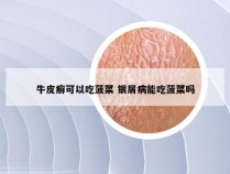 牛皮癣可以吃菠菜 银屑病能吃菠菜吗