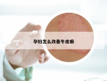 孕妇怎么改善牛皮癣