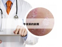 牛皮藓的前期