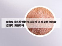 百癣夏塔热片例假可以吃吗 百癣夏塔热胶囊经期可以服用吗