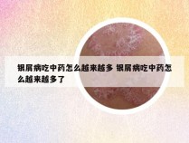 银屑病吃中药怎么越来越多 银屑病吃中药怎么越来越多了