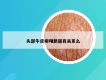 头部牛皮癣和肠道有关系么