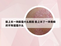 脸上长一块藓是什么原因 脸上长了一块像癣的不知道是什么