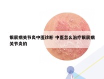 银屑病关节炎中医诊断 中医怎么治疗银屑病关节炎的