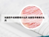 玩固性牛皮癣要用什么药 玩固性手癣用什么药
