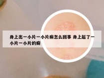 身上出一小片一小片癣怎么回事 身上起了一小片一小片的癣