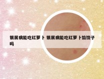 银屑病能吃红萝卜 银屑病能吃红萝卜馅饺子吗
