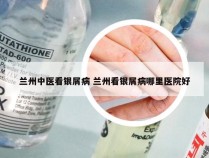 兰州中医看银屑病 兰州看银屑病哪里医院好