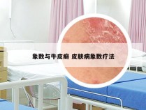 象数与牛皮癣 皮肤病象数疗法