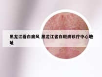黑龙江看白癜风 黑龙江省白斑病诊疗中心地址