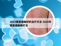 2023银屑病最好的治疗方法 2020年银屑病最新疗法