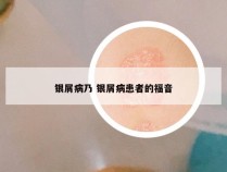 银屑病乃 银屑病患者的福音