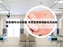 银屑病可以吃螃蟹 寻常型银屑病能吃淡水螃蟹