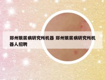 郑州银屑病研究所机器 郑州银屑病研究所机器人招聘