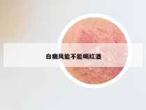 白癜风能不能喝红酒