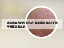 银屑病自愈的可能性大 银屑病能自愈?不妨听听医生怎么说