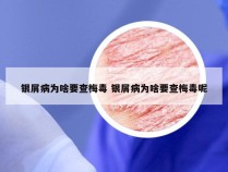 银屑病为啥要查梅毒 银屑病为啥要查梅毒呢