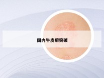 国内牛皮癣突破