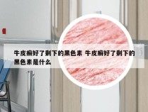 牛皮癣好了剩下的黑色素 牛皮癣好了剩下的黑色素是什么
