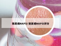 银屑病NAPSI 银屑病NAPSI评分