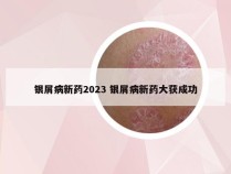 银屑病新药2023 银屑病新药大获成功