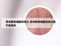 贵州银屑病医院简介 贵州银屑病医院简介是不是真的