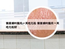 银屑病叶酸片一天吃几粒 银屑病叶酸片一天吃几粒好
