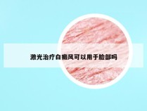 激光治疗白癜风可以用于脸部吗