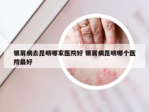 银屑病去昆明哪家医院好 银屑病昆明哪个医院最好