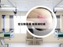 定位银屑病 银屑病权威