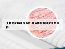 儿童银屑病临床治愈 儿童银屑病临床治愈案例