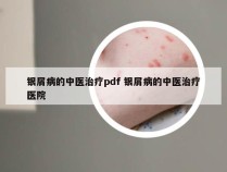 银屑病的中医治疗pdf 银屑病的中医治疗医院