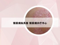 银屑病朱良春 银屑病诊疗中心