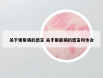 关于银屑病的感言 关于银屑病的感言和体会
