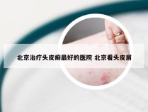 北京治疗头皮癣最好的医院 北京看头皮屑