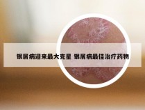 银屑病迎来最大克星 银屑病最佳治疗药物