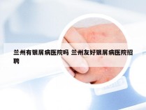 兰州有银屑病医院吗 兰州友好银屑病医院招聘