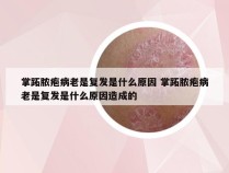 掌跖脓疱病老是复发是什么原因 掌跖脓疱病老是复发是什么原因造成的