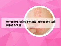 为什么说牛皮癣喝牛奶会发 为什么说牛皮癣喝牛奶会发病