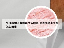 小孩胳膊上长癣是什么原因 小孩胳膊上有癣怎么回事