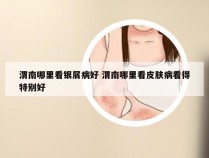 渭南哪里看银屑病好 渭南哪里看皮肤病看得特别好