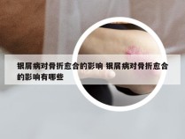 银屑病对骨折愈合的影响 银屑病对骨折愈合的影响有哪些