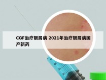 CGF治疗银屑病 2021年治疗银屑病国产新药